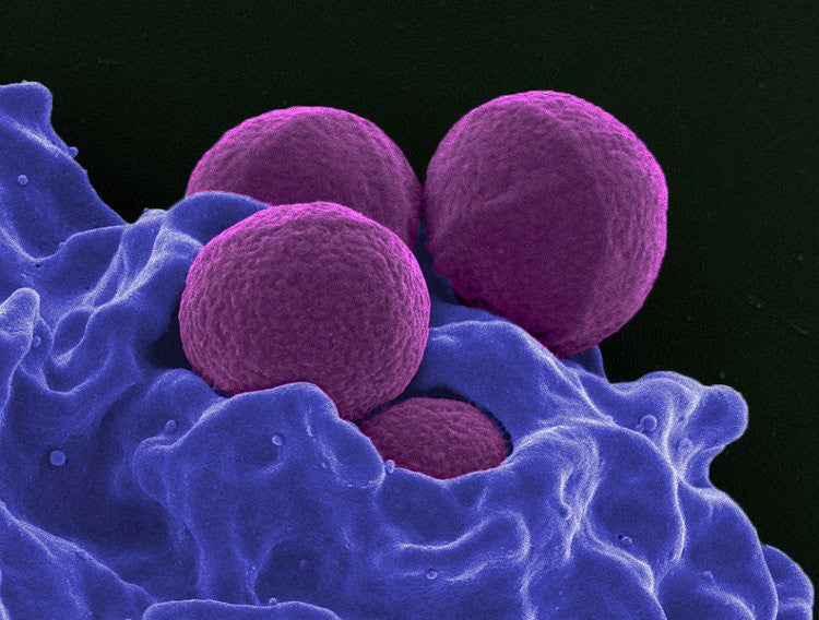 MRSA can live for up to 7 days on aircraft surfaces